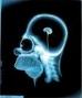20071203183309-cerebro1.jpg